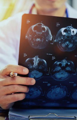 department angiography